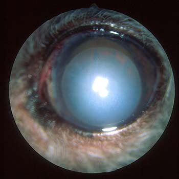 anterior-lens-lux