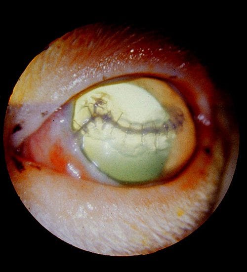 corneal-laceration1